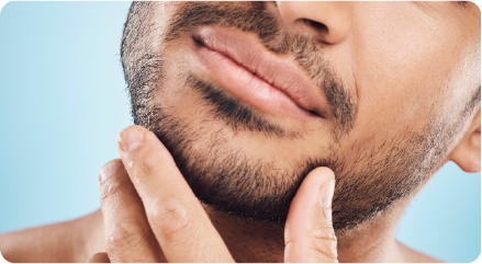 Bioestimulación Facial